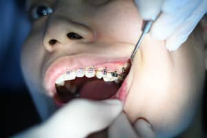 teeth